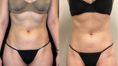 Tone woman body in Melbourne