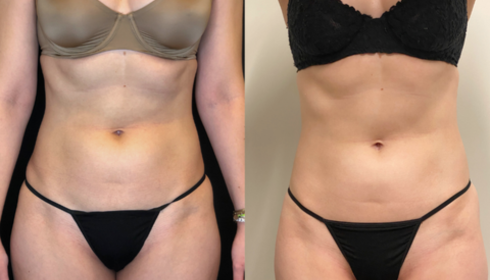 Tone woman body in Melbourne